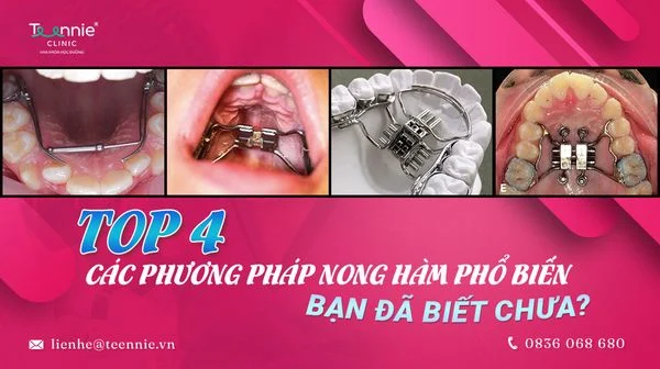 top 4 cac phuong phap nong ham pho bien ban da biet chua 78f91ca66333458fa45d82a4a5b96e66 grande