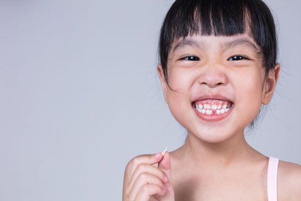 Độ tuổi phù hợp để niềng răng cho trẻ em là bao nhiêu?
