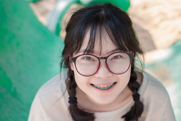 Giai đoạn lý tưởng niềng răng cho trẻ em