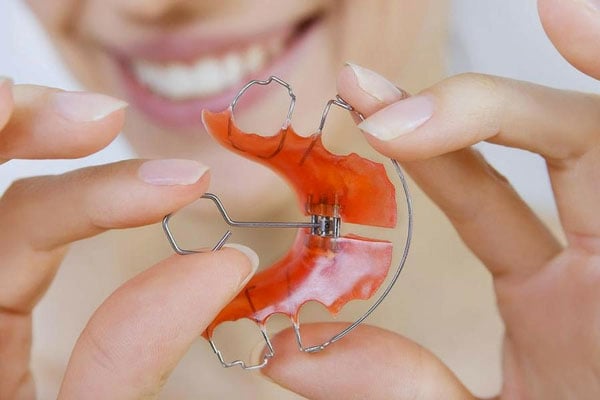 Phương pháp hàm duy trì tháo lắp kim loại