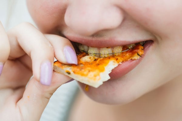 Người niềng răng ăn gì hoặc kiêng gì?
