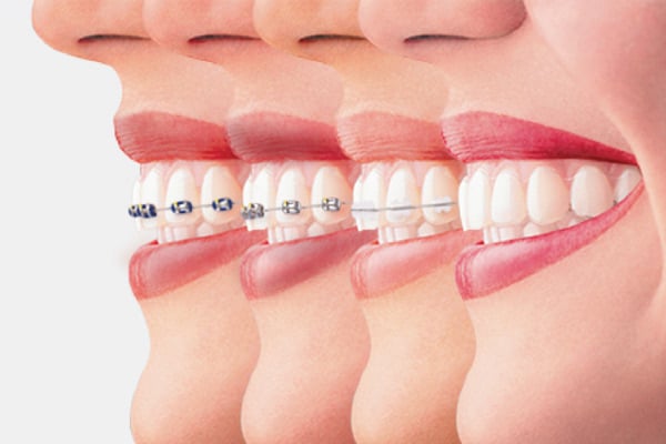 Những địa điểm nha khoa uy tín niềng răng