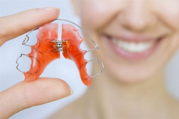 Chăm sóc răng sau khi niềng 
