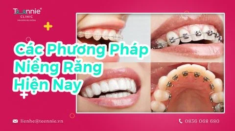 cac phuong phap nieng rang bia 1c495d13e22143b08ec309b7eb39a0b1 large