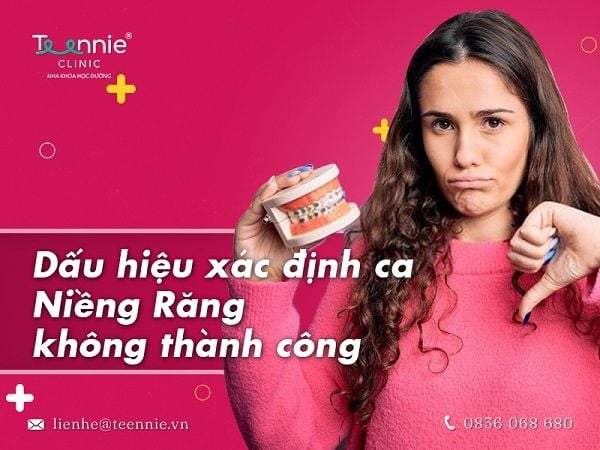 Dấu hiệu xác định niềng răng không thành công?