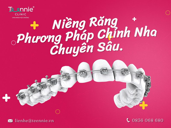 Kiểm tra định kỳ thường xuyên sau quá trình niềng răng