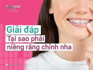 Tại sao phải niềng răng?