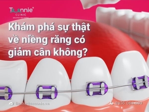Niềng răng có thật sự giảm cân hay không?