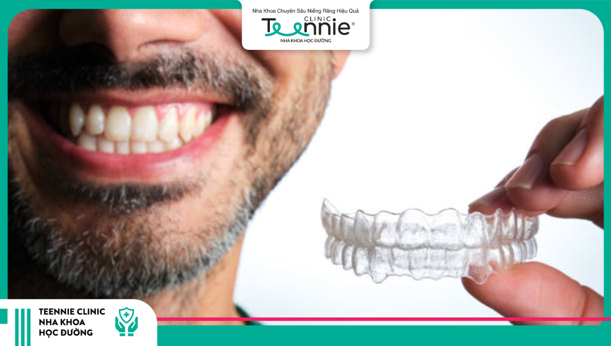 40 tuổi niềng răng được không?