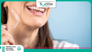 40 tuổi có niềng răng được không?