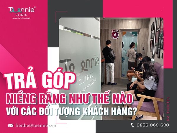 Thanh toán trả góp niềng răng dễ dàng đối với mọi đối tượng khách hàng