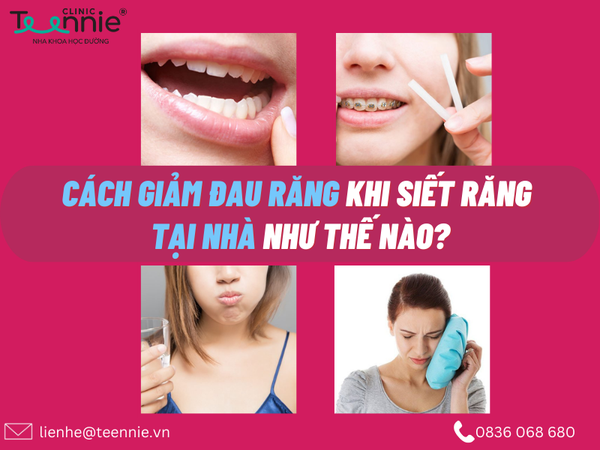 Chi tiết các cách giảm đau khi siết răng tại nhà cụ thể