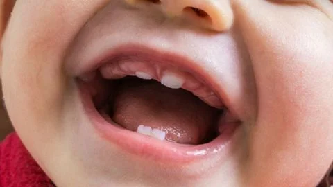 Trẻ 9 tháng tuổi chưa mọc răng: Cha mẹ đừng hoảng!