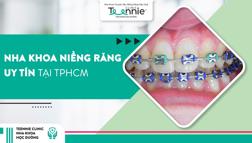 nha khoa nieng rang uy tin tai tphcm