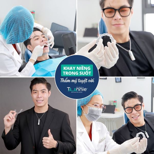 Những vấn đề liên quan đến niềng răng trong suốt