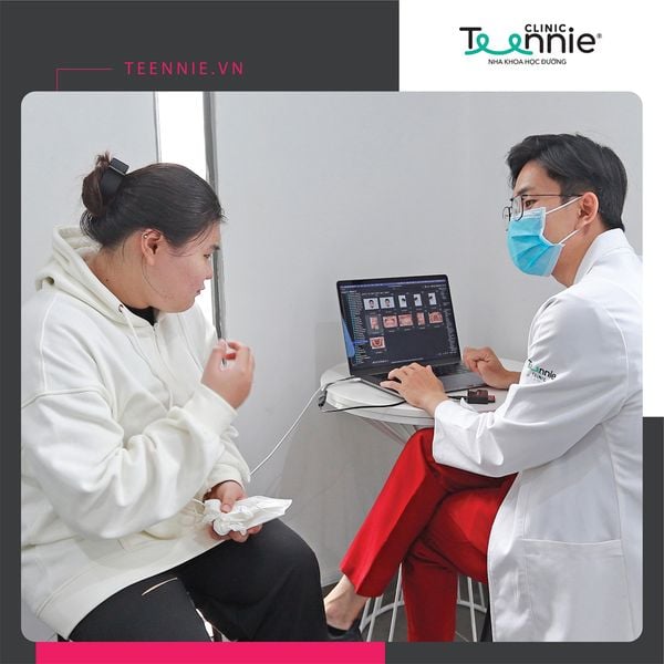 Lộ trình và chi phí niềng răng cửa thưa