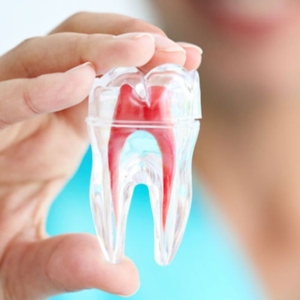4 điều không nên làm trước khi khám răng