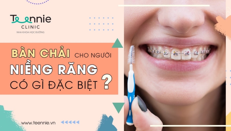 Bàn chải cho người niềng răng có khác gì bàn chải thông thường?