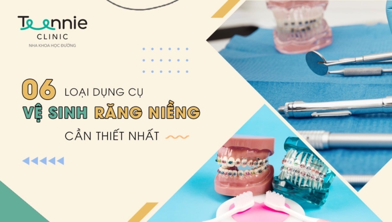 Bật mí 6 loại dụng cụ vệ sinh răng niềng cần thiết nhất