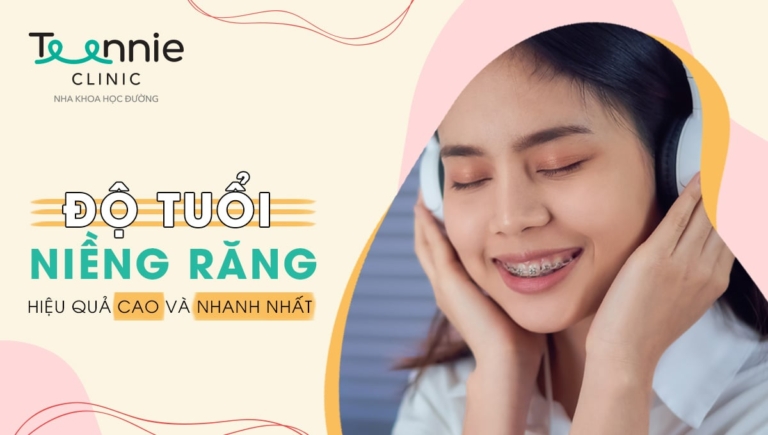 Biết ngay độ tuổi niềng răng hiệu quả cao và nhanh nhất