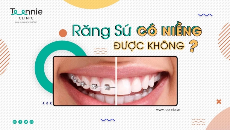 Giải đáp thắc mắc bọc răng sứ có niềng được không?