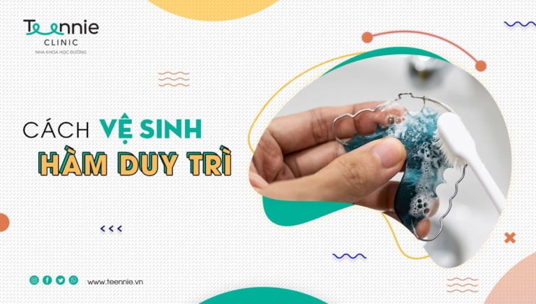 Hướng dẫn cách vệ sinh hàm duy trì sau khi niềng răng