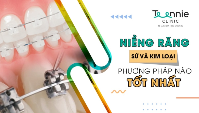 Lưu bản nháp tự động