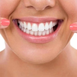 Muốn nụ cười đẹp thì nên lấy cao răng!
