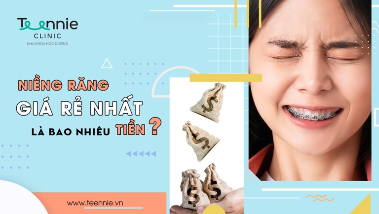 Niềng răng giá rẻ nhất là bao nhiêu tiền?