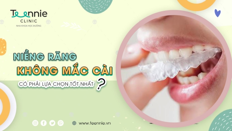 Niềng răng không mắc cài giá bao nhiêu? Và có phải lựa chọn tốt nhất?