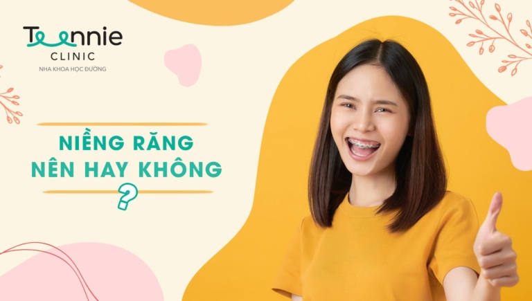 Niềng răng nên hay không? – 10 lợi ích tuyệt vời không thể bỏ qua