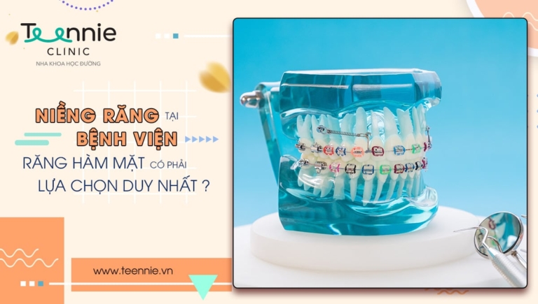 Niềng răng tại bệnh viện răng hàm mặt có phải lựa chọn duy nhất?