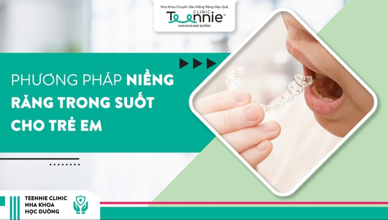 Niềng răng trong suốt cho trẻ em có hiệu quả không?