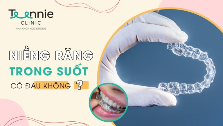 Niềng răng trong suốt có đau không? Hiệu quả như thế nào?