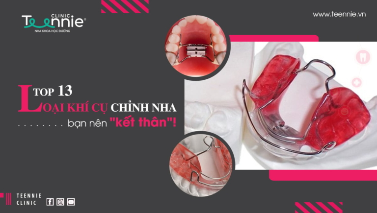 các loại khí cụ chỉnh nha