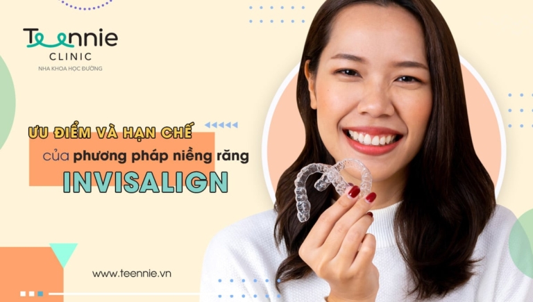 Ưu điểm và hạn chế của phương pháp niềng răng Invisalign