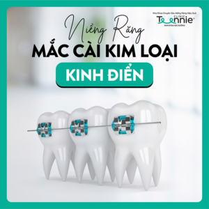 nieng rang mac cai kim loai banner01