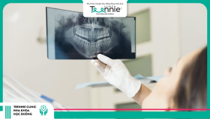 Chụp X-quang là bước đầu tiên quan trọng trong nguyên lý niềng răng