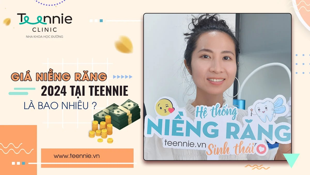 Niềng răng giá bao nhiêu?