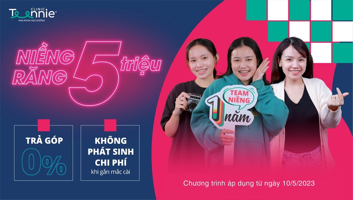 Chính sách niềng răng trả góp 0% cho sinh viên