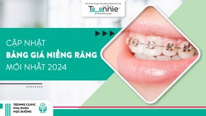 Cập nhật bảng giá niềng răng tháng 12/2024