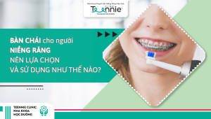 Lựa chọn và sử dụng bàn chải cho người niềng răng đúng cách