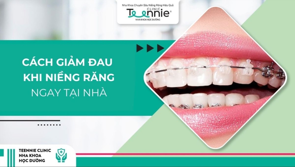 Cách giảm đau khi niềng răng tức thời ngay tại nhà