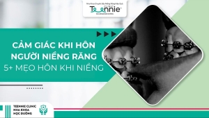 Cảm giác khi hôn người niềng răng
