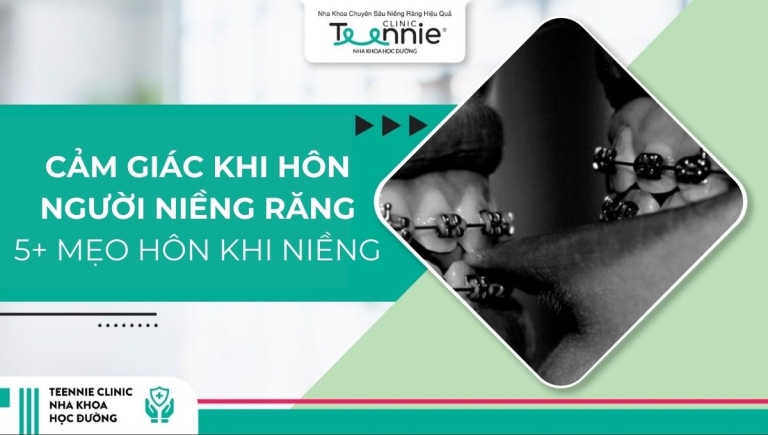 Cảm giác khi hôn người niềng răng