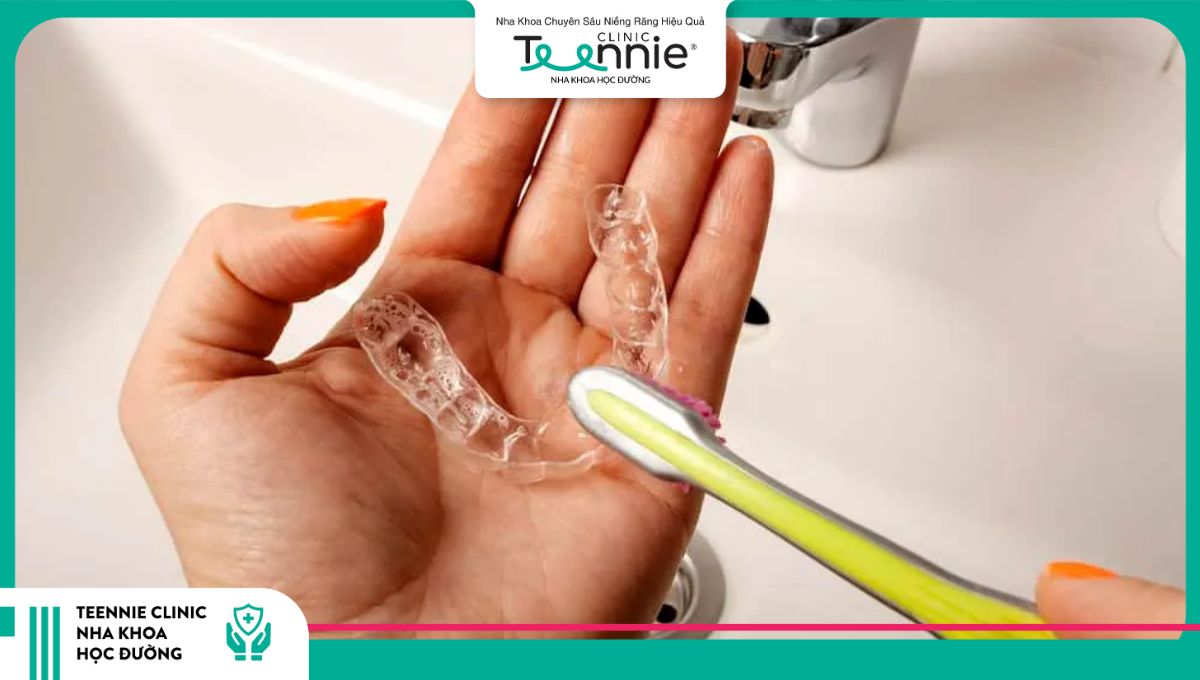 Vệ sinh toàn bộ mặt trong ngoài của hàm duy trì trong suốt