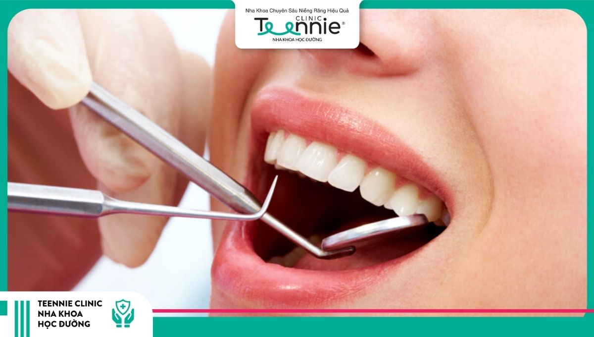 Nhổ răng trước khi niềng có thật sự cần thiết?