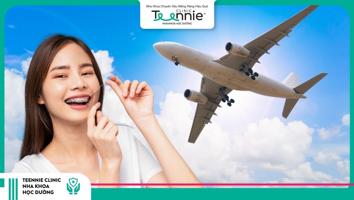 Cần lưu ý những gì khi đi máy bay trong quá trình niềng răng?