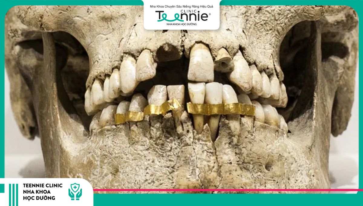 Những công cụ niềng răng cổ đại được tìm thấy trên xác ướp Ai Cập