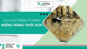 Tìm hiểu về lịch sử hình thành niềng răng thời xưa